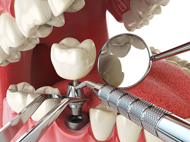 Trusted NC Emergency Dental Service Experts